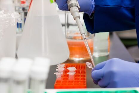 Eine Person arbeitet in einem Labor mit einer Pipette zum Dosieren von Flüssigkeiten.